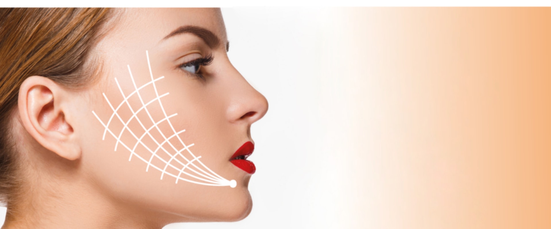 Which Thread Lift Lasts the Longest?
