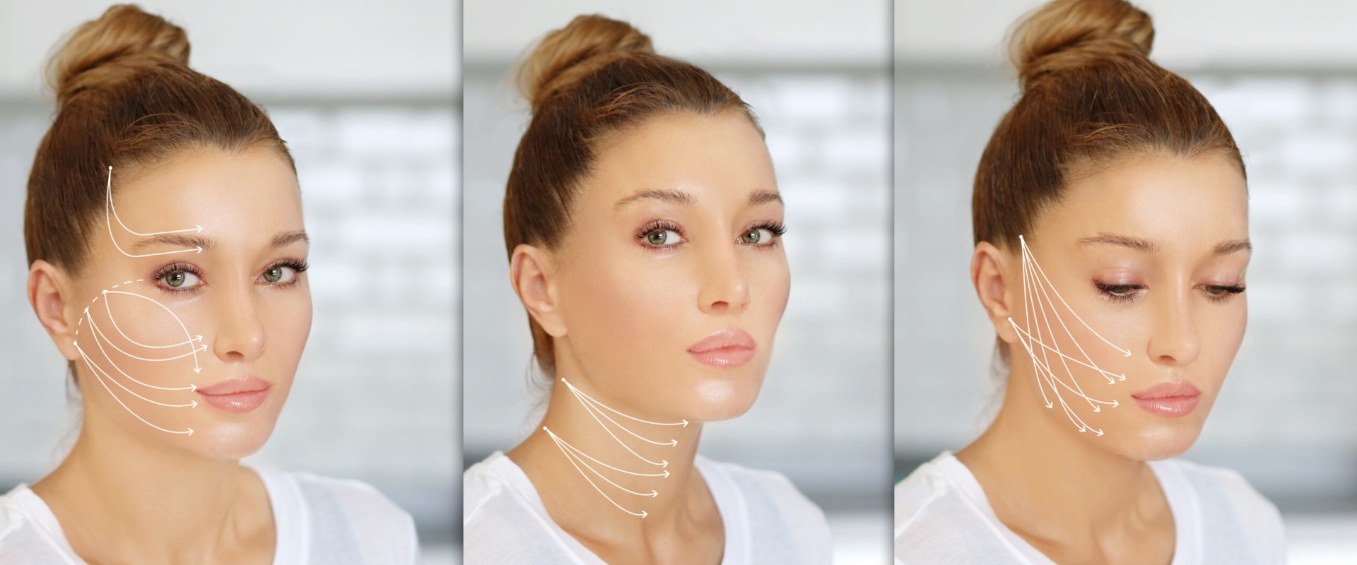 Can the Thread Lift be Reversed? An Expert's Perspective