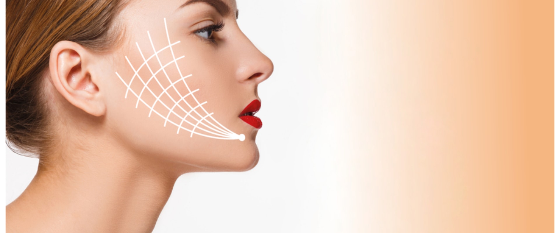 How Long Does It Take for a Thread Lift to Settle?