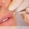 Do Thread Lifts Last Longer Than Fillers?