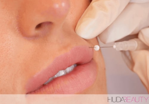 Do Thread Lifts Last Longer Than Fillers?
